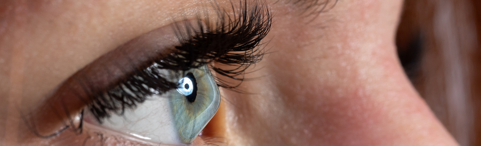 Banner image for Has AI Transformed Keratoconus Care?