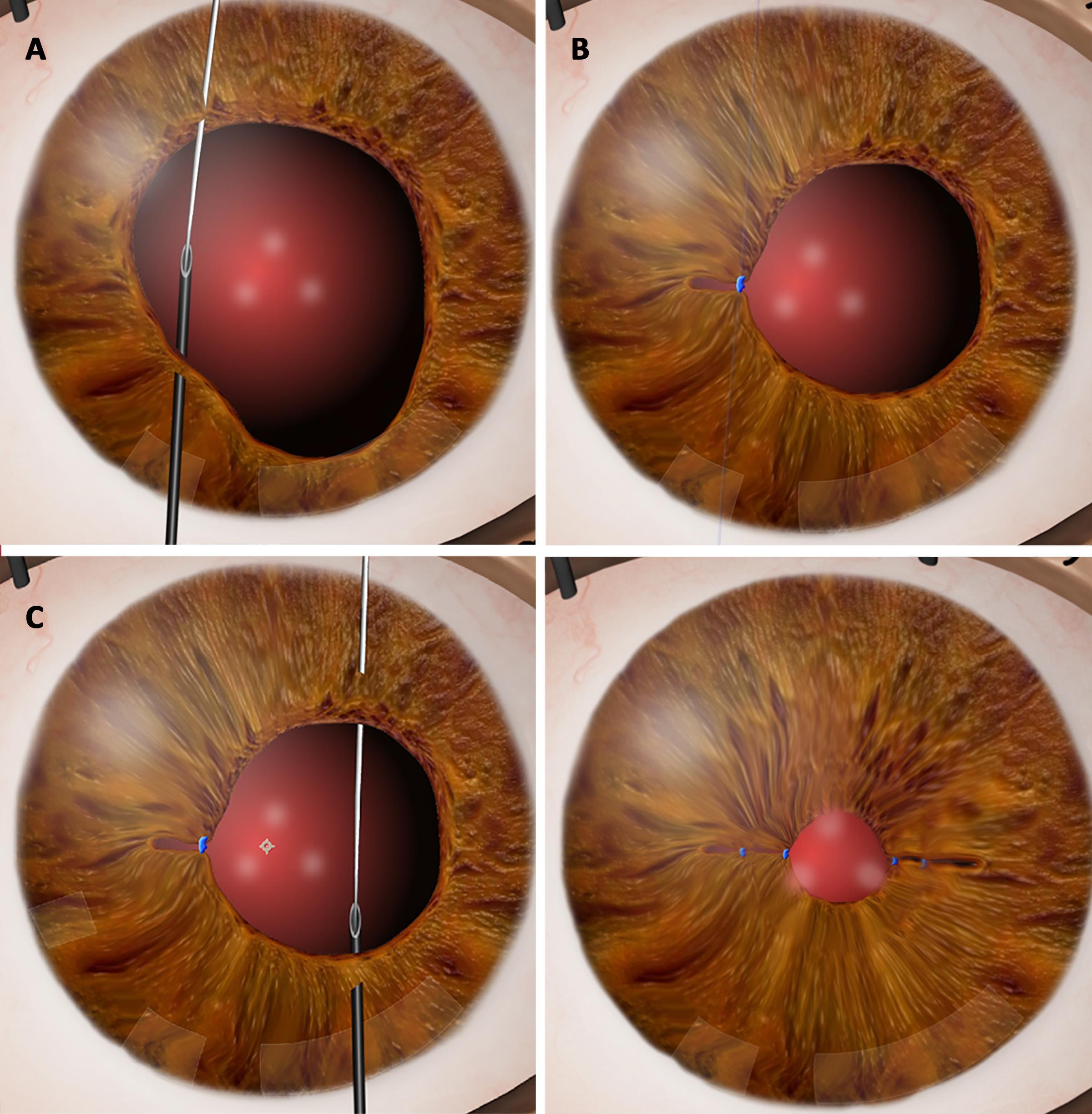 Need to Know: Who Should Receive PPP for Aberropia? 