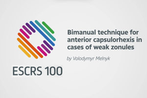 Bimanual technique for anterior capsulorhexis in cases of weak zonules - Volodymyr Melnyk