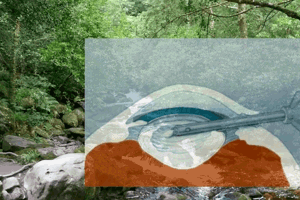 Instructional Course: Endophthalmitis after cataract surgery & intravitreal injections