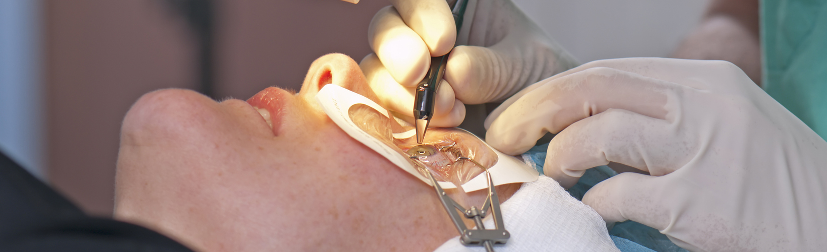 Banner image for Postoperative Corneal Complications