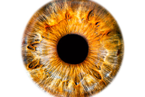 Knowing Iris Repair: Pupilloplasty