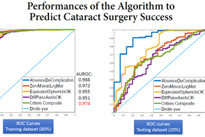 Using AI to Predict Cataract Surgery Success