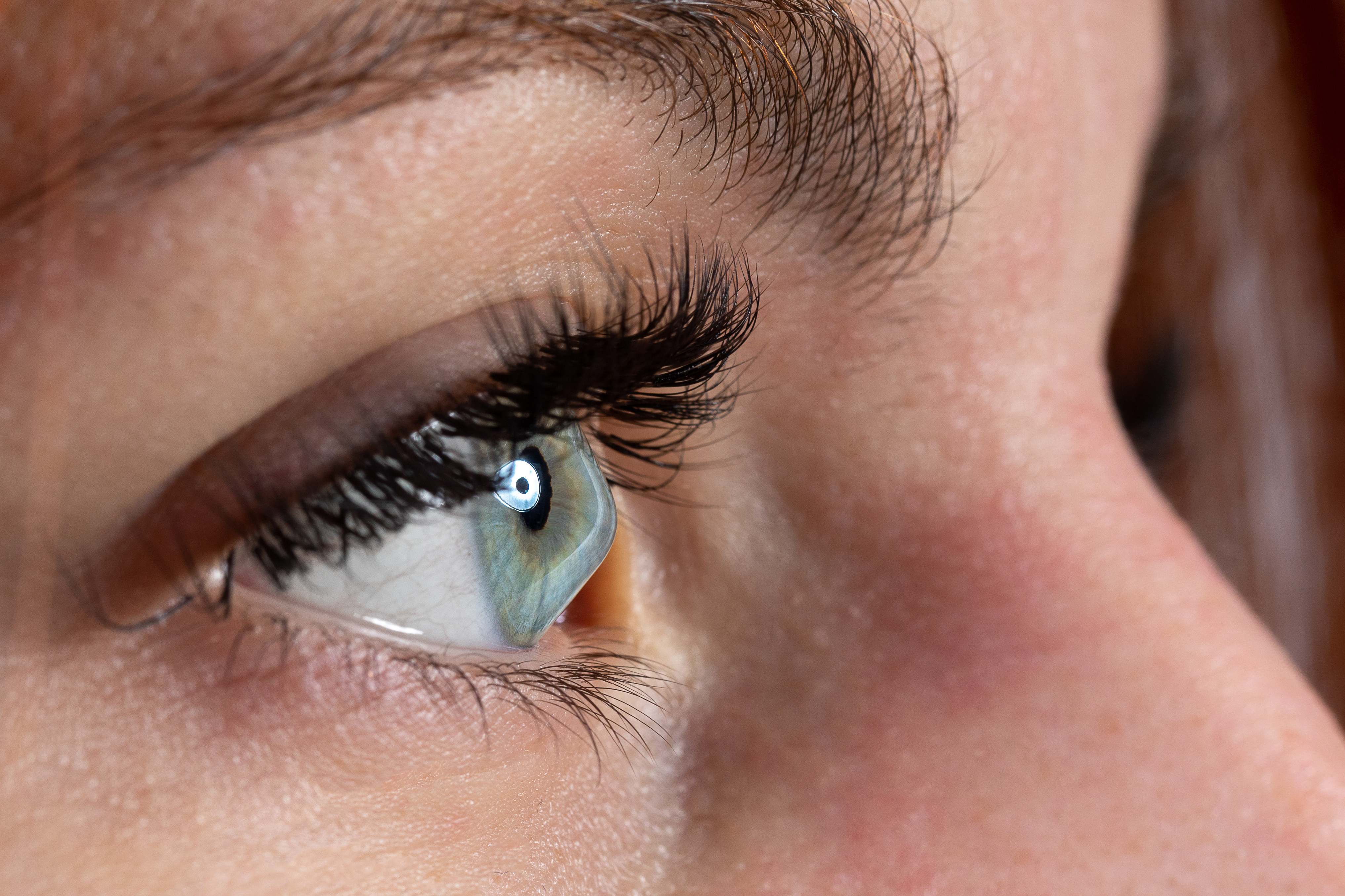 Has AI Transformed Keratoconus Care?