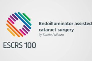 Endoilluminator assisted cataract surgery - Sotiria Palioura