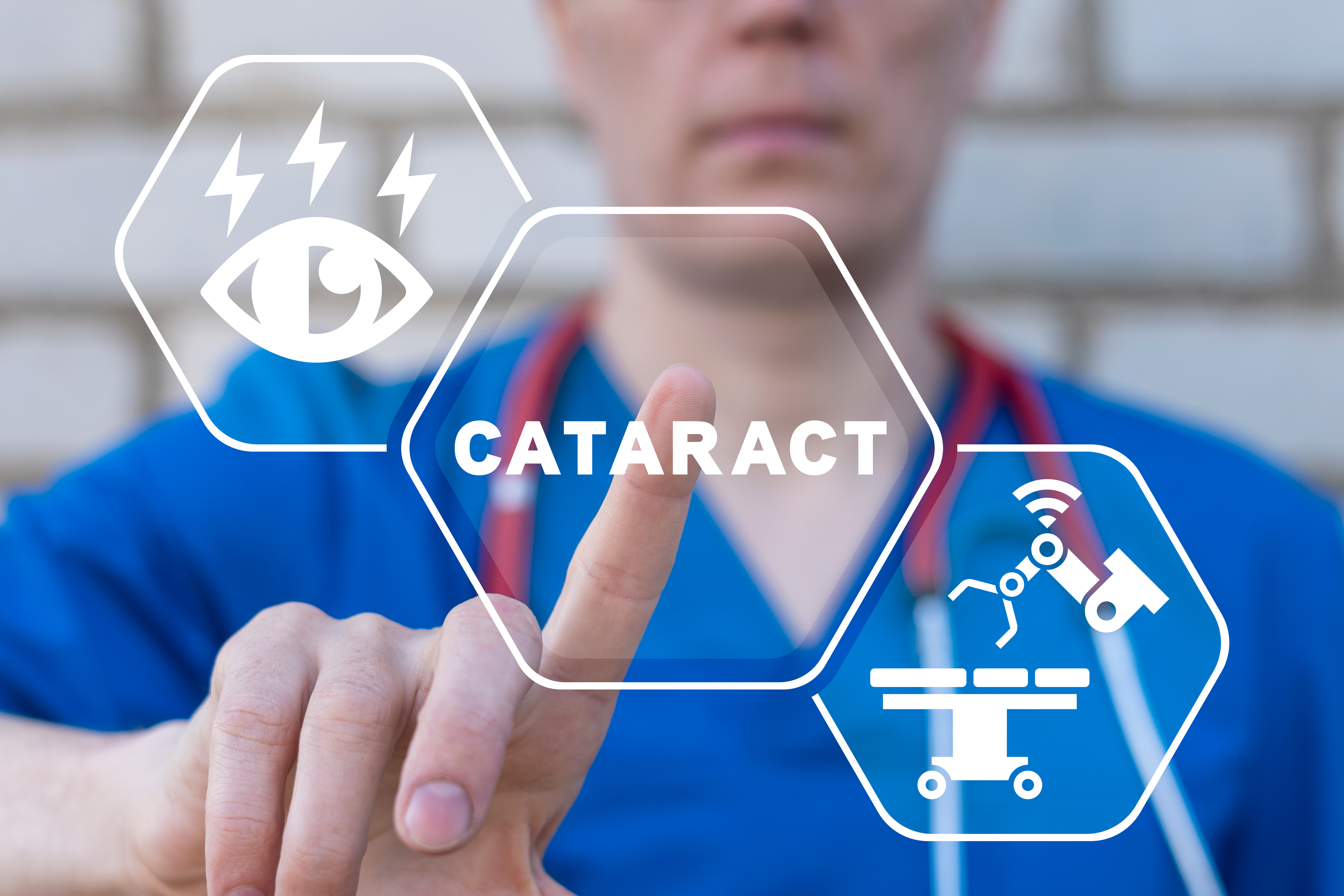 Robotics in Cataract Surgery: Coming Soon? 