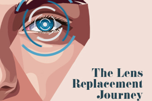 The Lens Replacement Journey