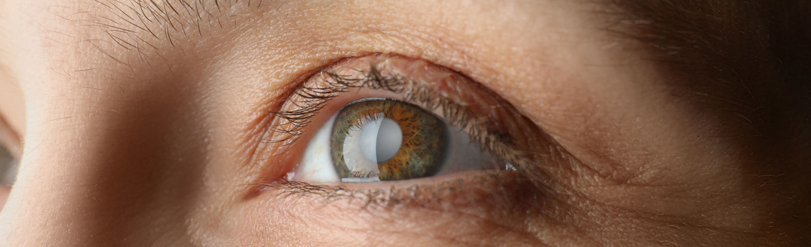 Banner image for Results of Paul Glaucoma Implant Surgery in Ireland
