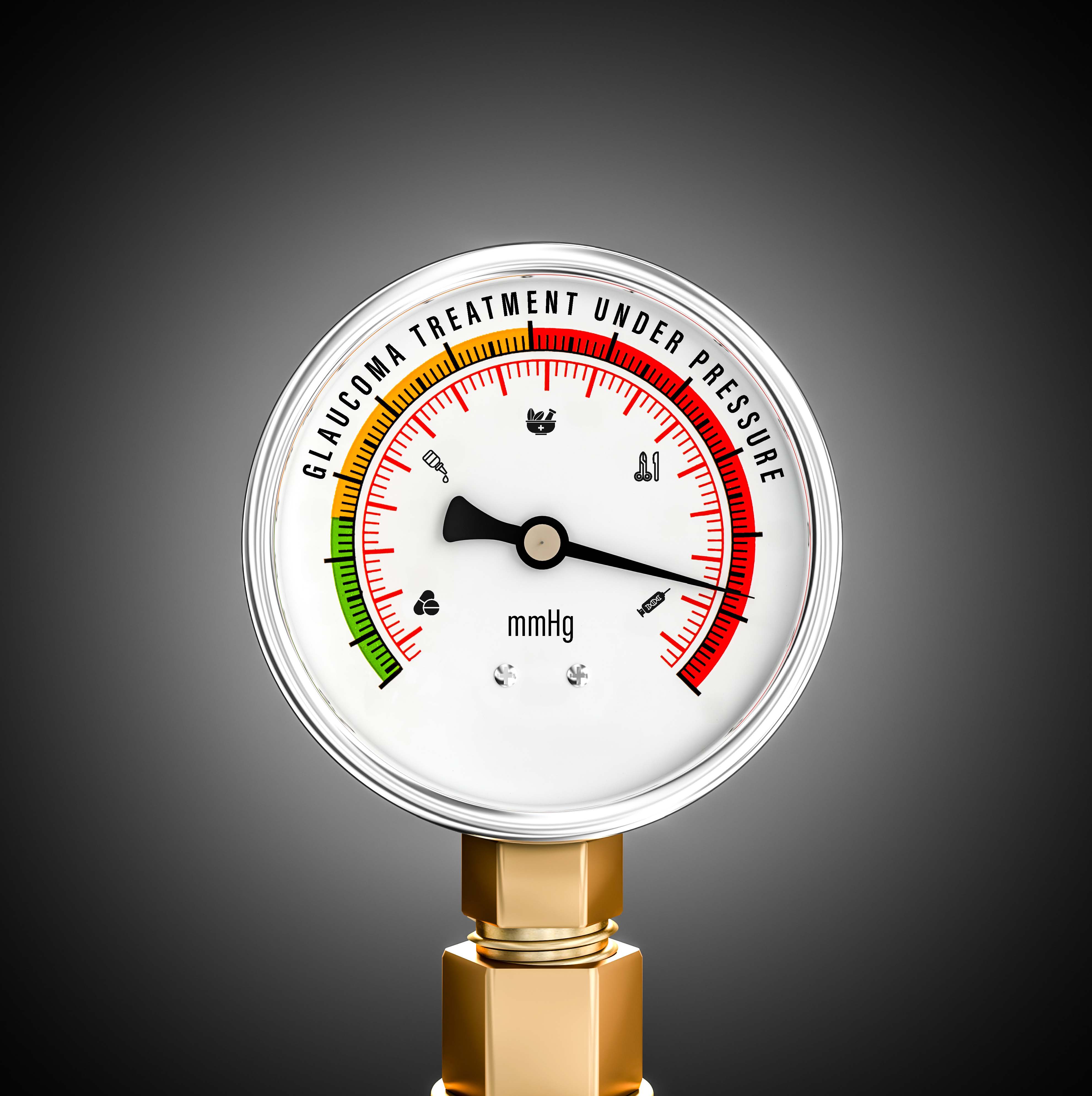 Glaucoma Treatment Under Pressure