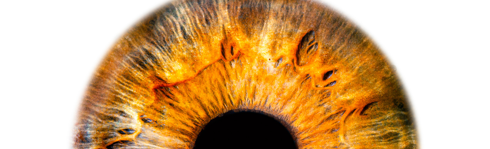Banner image for Knowing Iris Repair: Pupilloplasty