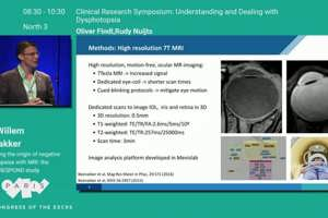 Uncovering the origin of negative dysphotopsias with MRI: the ESCRS vRESPOND study
