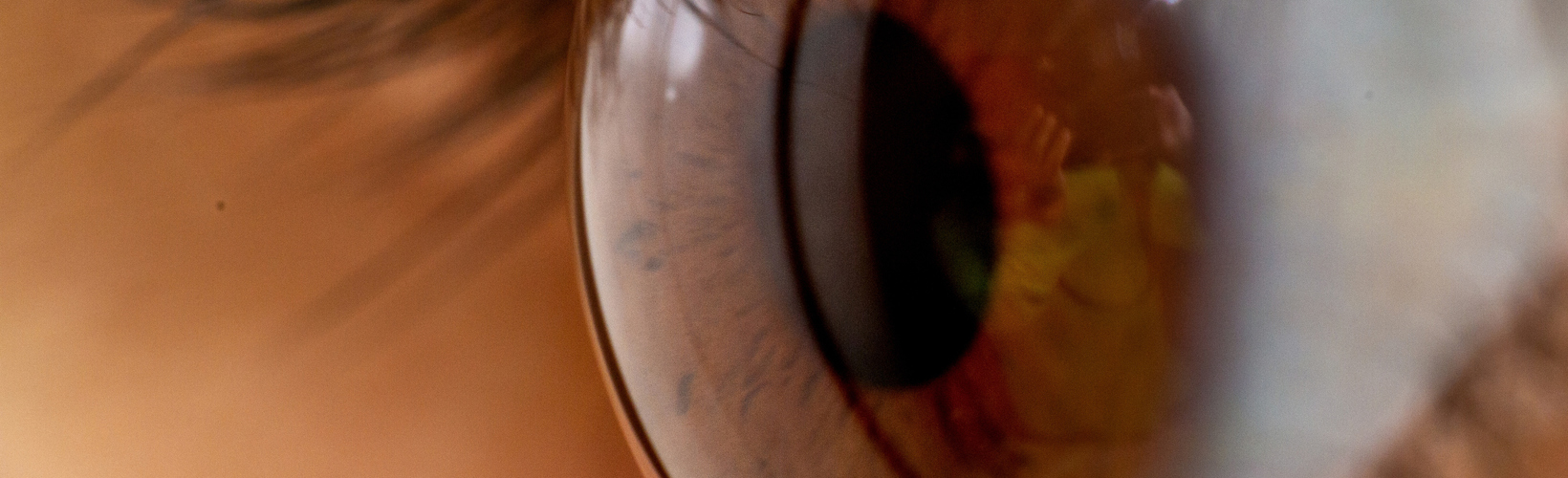 Banner image for The European Experience with KLEx