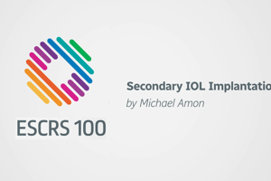 Secondary IOL implantation - Michael Amon