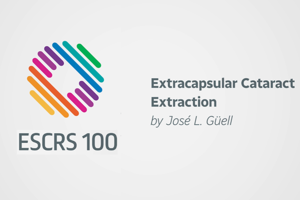 Extracapsular Cataract Extraction - José.L. Güell