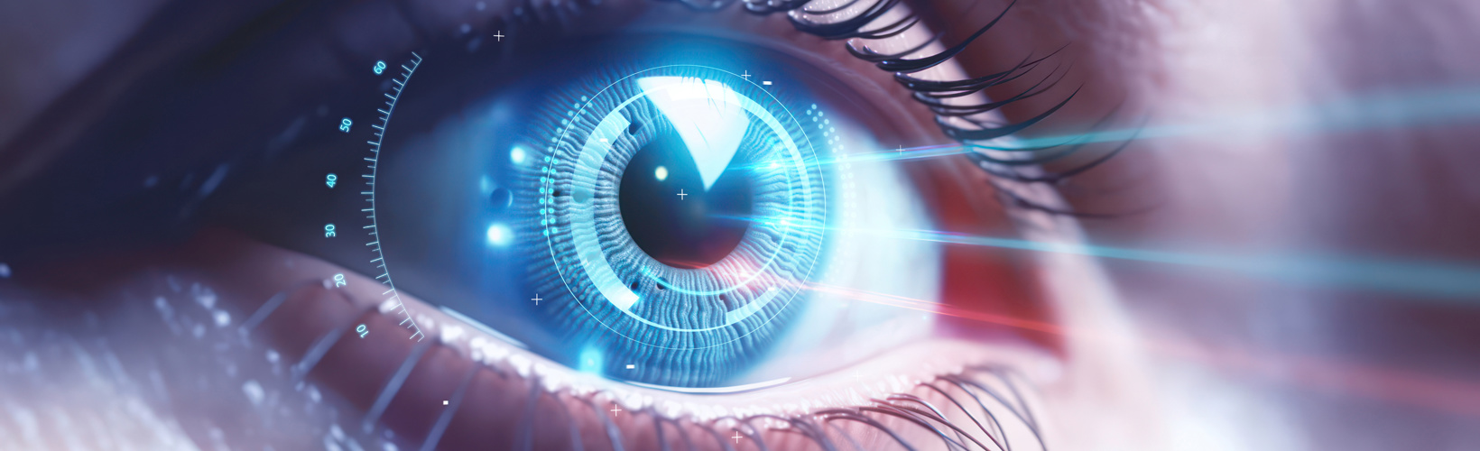 Refractive Femtosecond Laser